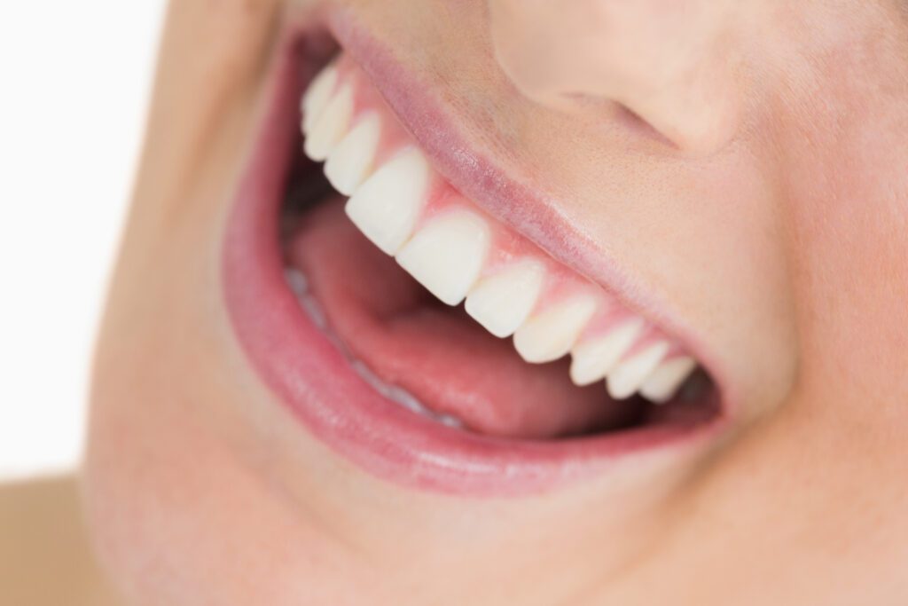 teeth whitening in Flower Mound, TX