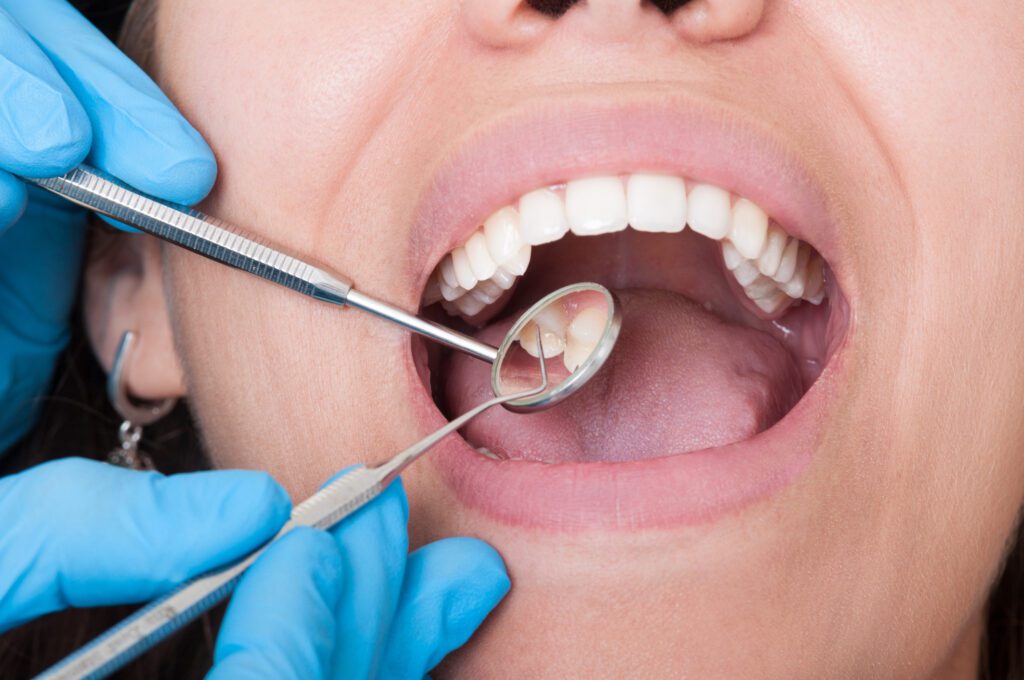 treatments for gum disease in Flower Mound, TX